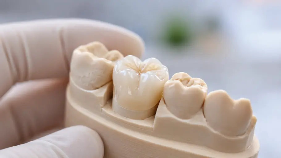 Posterior Full Zirconia — product shot
