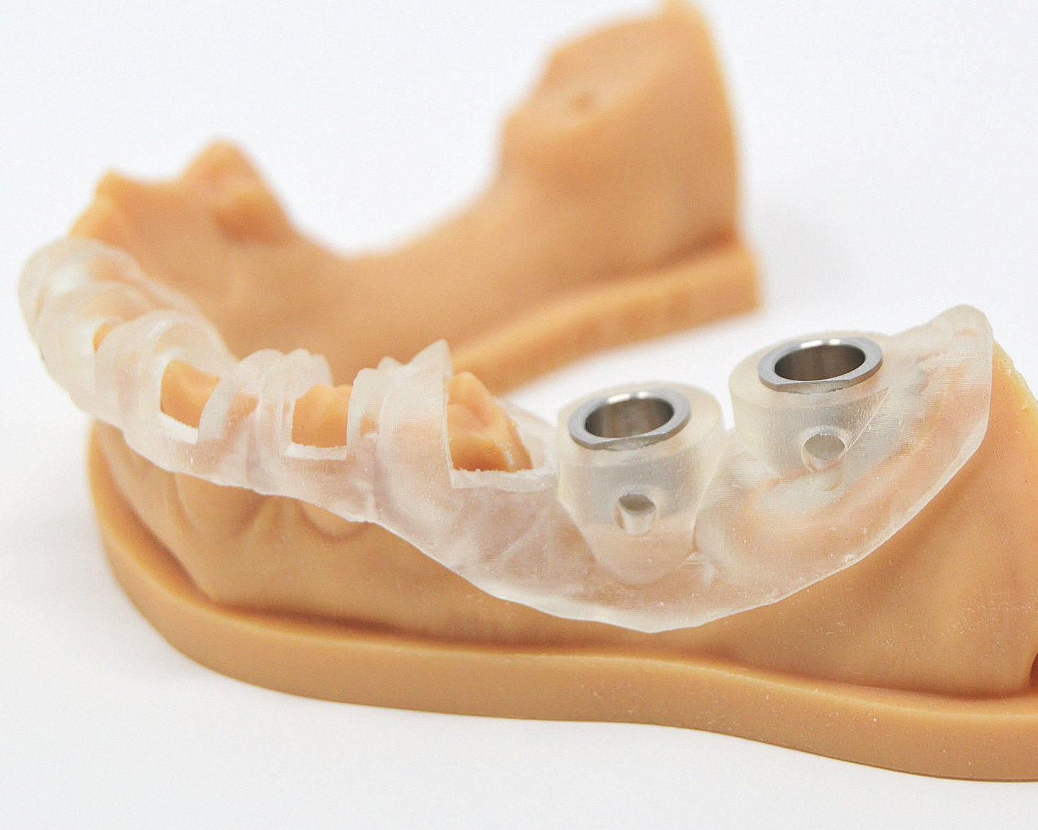 Implant Surgical Guide — product shot