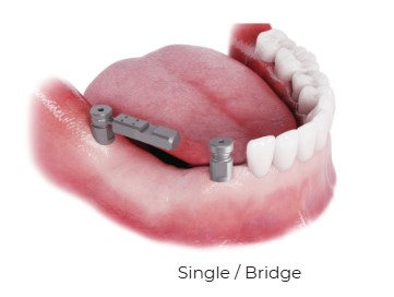 All on X — image 8