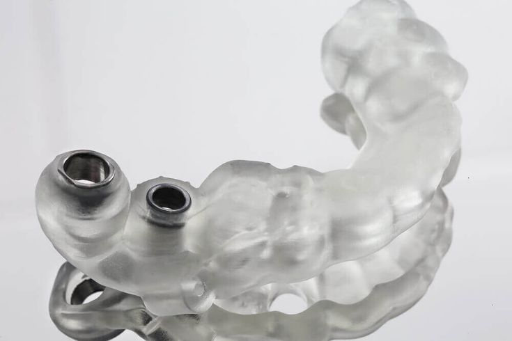 Implant Surgical Guide — image 1